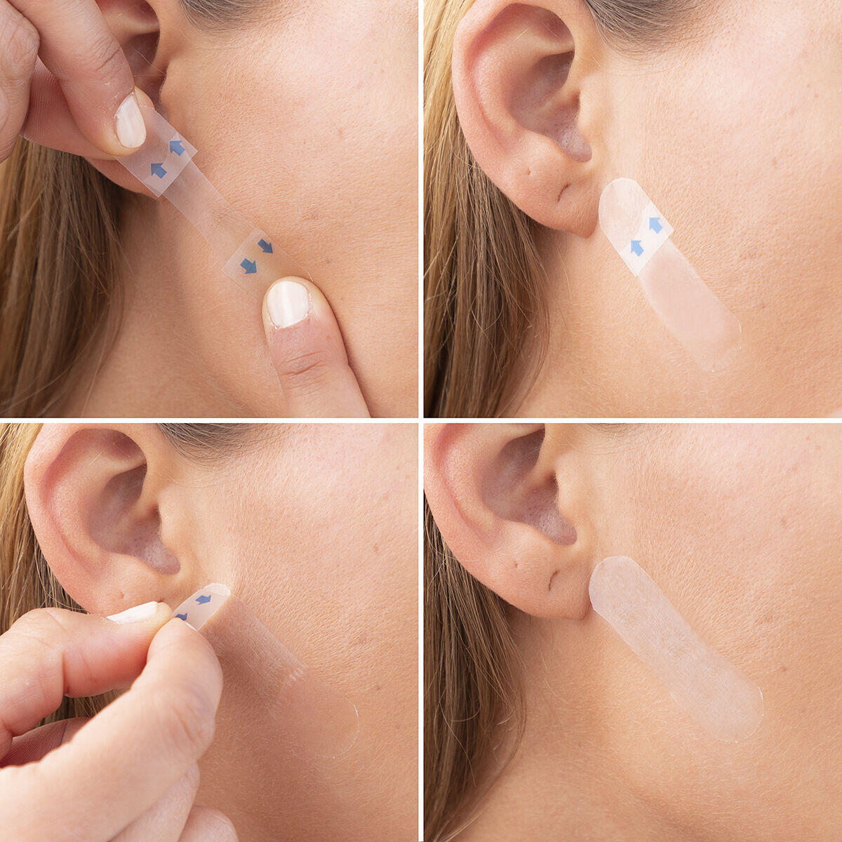 Lifting Facial Adhesivos